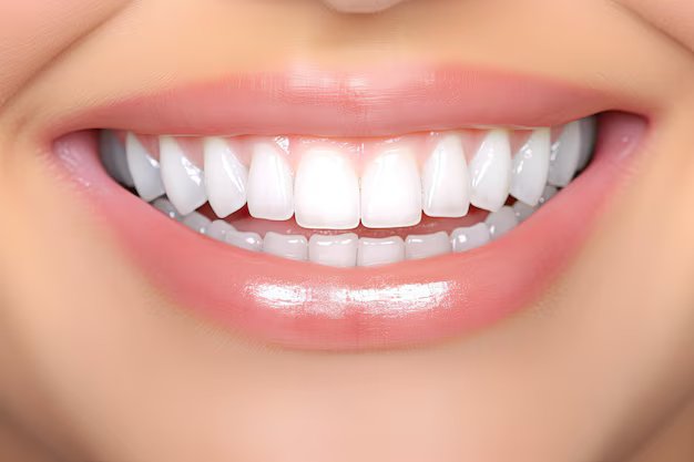 Teeth Whitening